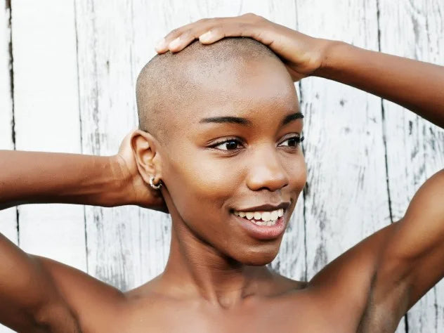 What is Alopecia?